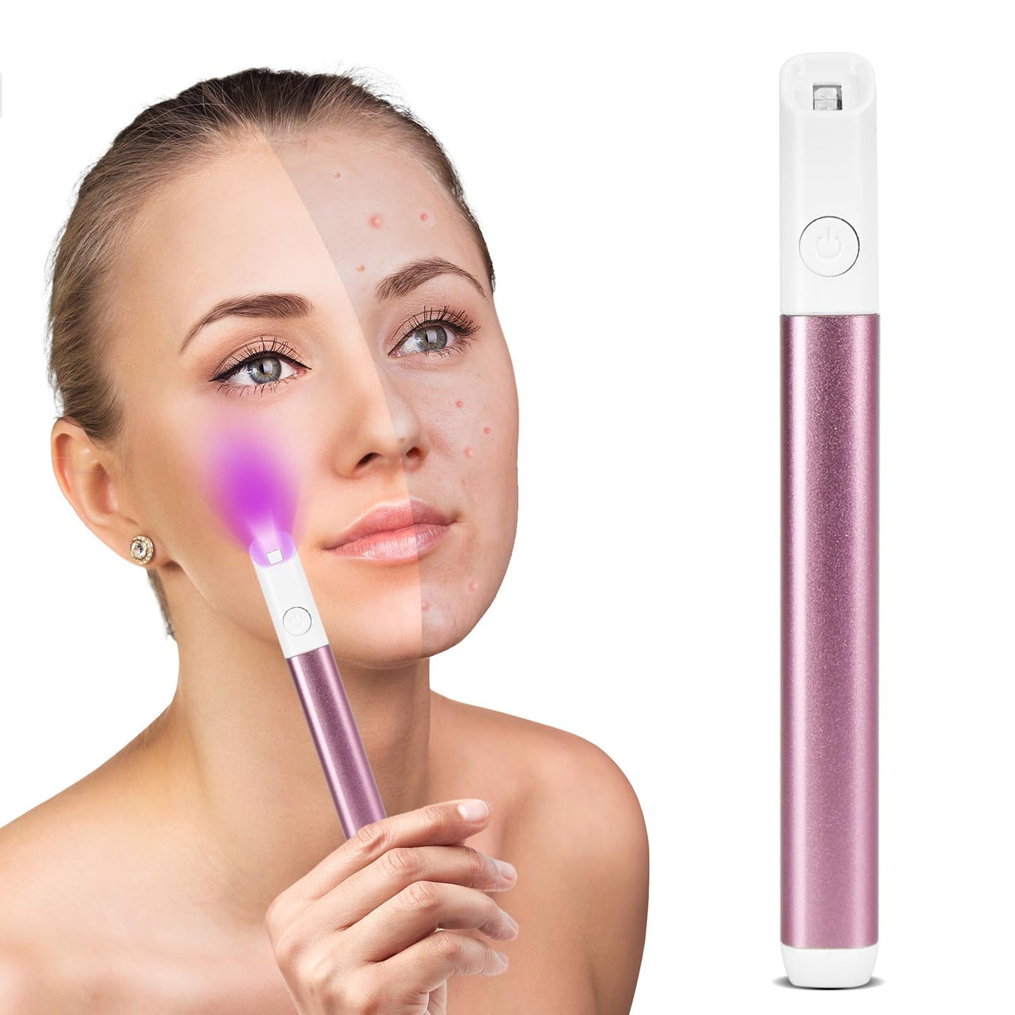 Red and Blue Light Therapy Pen